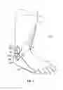 Fig. 02 - Ankle flexible support system