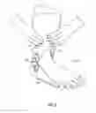 Fig. 04 - Ankle flexible support system