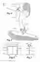 Fig. 02 - Fascia therapy tool