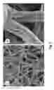 Fig. 06 - HYDROGEL SCAFFOLD FOR THREE DIMENSIONAL CELL CULTURE