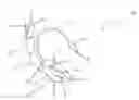 Fig. 01 - Device for securing airway and ventilation during robotic surgery of the head and neck