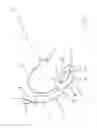 Fig. 02 - Device for securing airway and ventilation during robotic surgery of the head and neck