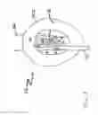 Fig. 04 - Device for securing airway and ventilation during robotic surgery of the head and neck