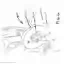 Fig. 07 - Device for securing airway and ventilation during robotic surgery of the head and neck