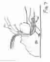 Fig. 08 - Device for securing airway and ventilation during robotic surgery of the head and neck