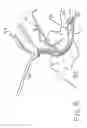 Fig. 09 - Device for securing airway and ventilation during robotic surgery of the head and neck