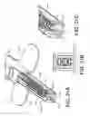 Fig. 22 - Needle assembly with needle safety shield