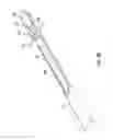 Fig. 07 - Methods, tools, and assemblies for implantation of medical leads having distal tip anchors