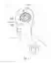 Fig. 02 - Non-regular electrical stimulation patterns for treating neurological disorders
