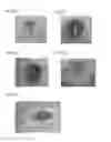 Fig. 09 - Foamed composite molding and method for manufacturing foamed composite molding