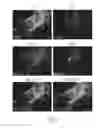 Fig. 14 - REPROGRAMMING CARDIOMYOCYTES WITH ONE TRANSCRIPTION FACTOR