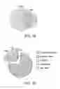 Fig. 02 - Methods and compositions for predicting a colon cancer subtype