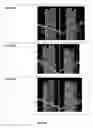 Fig. 07 - Wire rope barrier