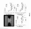 Fig. 06 - Method and system for in-silico design of skin electroporation