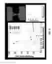 Fig. 08 - Method and system for in-silico design of skin electroporation