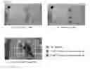 Fig. 13 - Method and apparatus for processing video signal on basis of combination of pixel recursive coding and transform coding