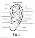 Fig. 02 - Human-ear-wearable apparatus, system, and method of operation