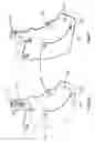 Fig. 06 - Single hand operated collapsing hanger