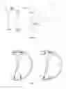Fig. 04 - C-arm with integrated CT system