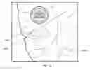 Fig. 20 - Microwave energy-delivery device and system