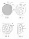 Fig. 02 - Hybrid breast implant, method for making and using same