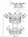 Fig. 02 - Prosthetic heart valve