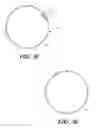 Fig. 07 - Cuff configurations for prosthetic heart valve