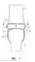 Fig. 02 - RESILIENT ARTHROPLASTY DEVICE