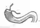 Fig. 01 - ATRAUMATIC GASTROINTESTINAL ANCHOR