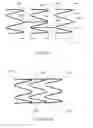 Fig. 06 - ATRAUMATIC GASTROINTESTINAL ANCHOR