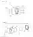 Fig. 09 - Hydro-block air vent combination catheter system and method of use