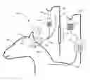 Fig. 01 - Systems and methods for enhanced distribution of a biologic agent within the brain and spinal cord