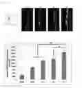 Fig. 04 - COMPOSITION COMPRISING DUAL IONIC PH-SENSITIVE COPOLYMER FOR DELIVERING SDF-1 TOPICALLY TO THE BRAIN AND USE THEREOF