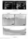 Fig. 09 - Artificial tissue progenitor and method for preparing the same