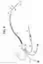 Fig. 07 - Systems and methods for intravascular catheter positioning and/or nerve stimulation