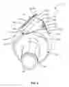 Fig. 06 - Cutting and deburring tool