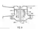 Fig. 07 - Isolation mount assembly