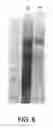 Fig. 06 - BIOPARTICLE ISOLATION AND THERAPEUTIC APPLICATION THEREOF