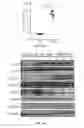 Fig. 09 - METHODS OF DIAGNOSING AND TREATING B CELL ACUTE LYMPHOBLASTIC LEUKEMIA