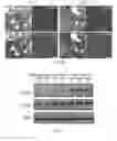 Fig. 13 - METHODS OF DIAGNOSING AND TREATING B CELL ACUTE LYMPHOBLASTIC LEUKEMIA