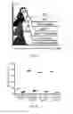 Fig. 19 - METHODS OF DIAGNOSING AND TREATING B CELL ACUTE LYMPHOBLASTIC LEUKEMIA