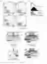 Fig. 24 - METHODS OF DIAGNOSING AND TREATING B CELL ACUTE LYMPHOBLASTIC LEUKEMIA