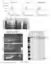 Fig. 25 - METHODS OF DIAGNOSING AND TREATING B CELL ACUTE LYMPHOBLASTIC LEUKEMIA