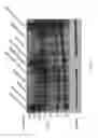 Fig. 35 - METHODS OF DIAGNOSING AND TREATING B CELL ACUTE LYMPHOBLASTIC LEUKEMIA