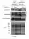 Fig. 37 - METHODS OF DIAGNOSING AND TREATING B CELL ACUTE LYMPHOBLASTIC LEUKEMIA