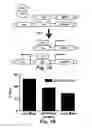 Fig. 02 - Method of determining the prognosis of hepatocellular carcinomas using a multigene signature associated with metastasis