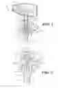 Fig. 02 - Regulator valve assembly and components thereof