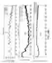 Fig. 45 - Sensor systems, devices, and methods for continuous glucose monitoring