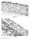 Fig. 12 - Engineered renal tissues, arrays thereof, and methods of making the same