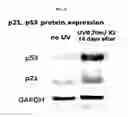 Fig. 06 - METHOD FOR PREPARING SENESCENT MELANOCYTES, CELLS PREPARED BY METHOD, AND METHOD FOR SCREENING FOR SENESCENCE-ALLEVIATING MATERIAL BY USING CELLS